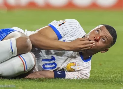 Ngôi sao Mbappe đứng trước nguy cơ chấn thương giữa thời kỳ thăng hoa
