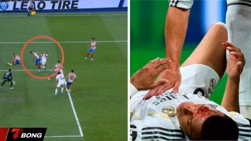 Không Penalty Cho Mbappe - Liệu Real Madrid Có Bị Xử Ép ?